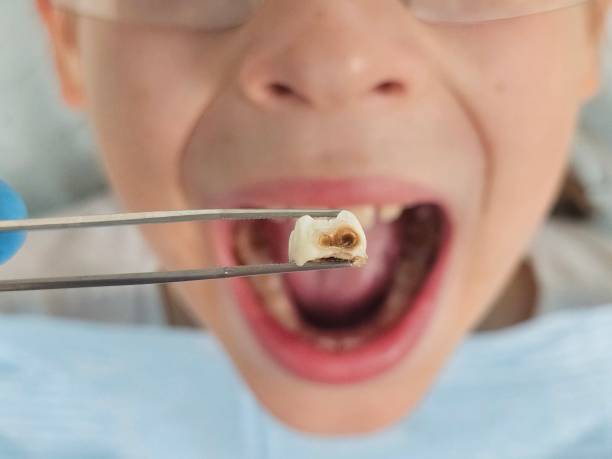 Best Emergency Dental Surgery in Osceola, IN